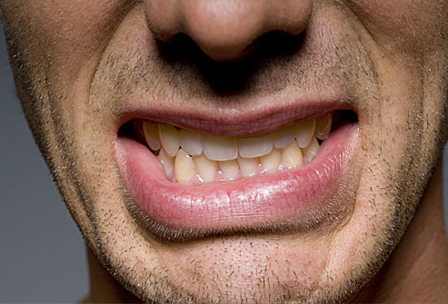Ποιες ασθένειες μπορούν αν προκληθούν από το τρίξιμο των δοντιών στον ύπνο; - Φωτογραφία 1