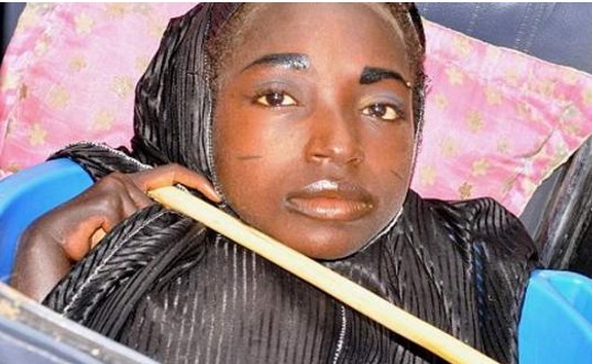 Νιγηρία: Δείτε την 19χρονη που ζει σε μία πλαστική λεκάνη  - Πάσχει από άγνωστη ασθένεια [photos+video] - Φωτογραφία 1