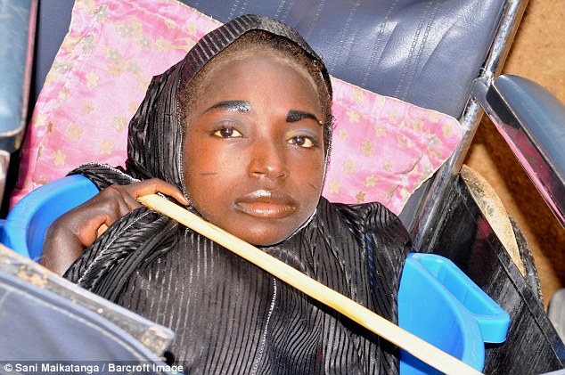 Νιγηρία: Δείτε την 19χρονη που ζει σε μία πλαστική λεκάνη  - Πάσχει από άγνωστη ασθένεια [photos+video] - Φωτογραφία 5