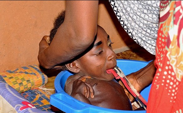 Νιγηρία: Δείτε την 19χρονη που ζει σε μία πλαστική λεκάνη  - Πάσχει από άγνωστη ασθένεια [photos+video] - Φωτογραφία 7