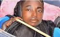 Νιγηρία: Δείτε την 19χρονη που ζει σε μία πλαστική λεκάνη  - Πάσχει από άγνωστη ασθένεια [photos+video] - Φωτογραφία 1