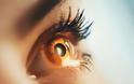 Ελιά στο μάτι: Πώς μοιάζει, τι είναι και πότε πρέπει να αφαιρείται ο σπίλος