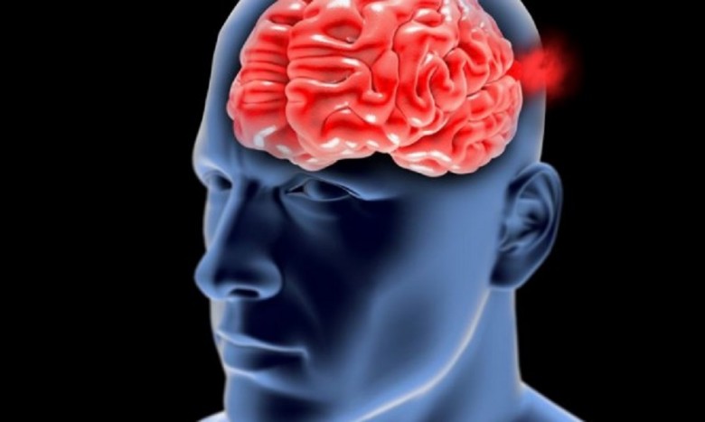 Ανεύρυσμα εγκεφάλου: Αιτίες, προειδοποιητικά σημεία και συμπτώματα - Φωτογραφία 1