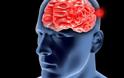 Ανεύρυσμα εγκεφάλου: Αιτίες, προειδοποιητικά σημεία και συμπτώματα