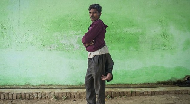 Ο 22χρονος με τα τέσσερα πόδια ελπίζει σε μια φυσιολογική ζωή - Φωτογραφία 1