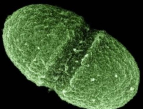 Enterococcus faecalis: Το μαγγάνιο παίζει σημαντικό ρόλο στη βακτηριακή μόλυνση - Φωτογραφία 1