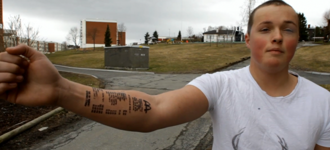 Η ανόητη απόφαση ενός εφήβου - Έκανε στο μπράτσο του τατουάζ μια... - Φωτογραφία 1