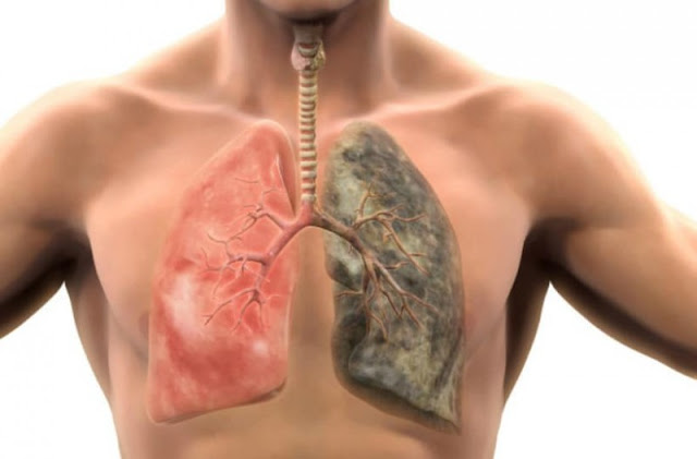 Σε πόσο καιρό θα καθαρίσουν τα πνευμόνια σου αν κόψεις το κάπνισμα; - Φωτογραφία 2