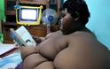 Το παχύτερο αγόρι στον κόσμο κατάφερε να χάσει 30 κιλά