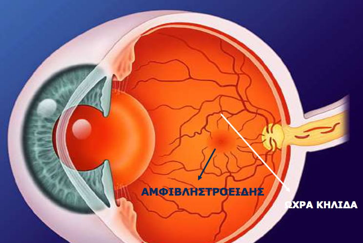 Αιτίες απώλειας όρασης και τρόποι αντιμετώπισης. Παγκόσμια Ημέρα Όρασης (κατά της τύφλωσης) - Φωτογραφία 3