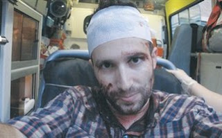 Άγριος ξυλοδαρμός ισραηλινού δημοσιογράφου από αγνώστους[ΒΙΝΤΕΟ] - Φωτογραφία 1