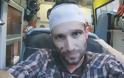 Άγριος ξυλοδαρμός ισραηλινού δημοσιογράφου από αγνώστους[ΒΙΝΤΕΟ]