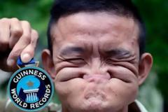 ΦΩΤΟ – ΒΡΑΒΕΙΟ ΓΚΙΝΕΣ: Η πιο άσχημη γκριμάτσα του κόσμου!