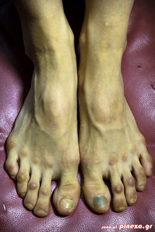 ΣΟΚ: Τα πόδια μιας επαγγελματία χορεύτριας μπαλέτου - Φωτογραφία 3