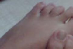 Πως να μην μπαίνουν τα νύχια των ποδιών στο κρέας