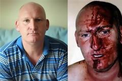 ΑΠΙΣΤΕΥΤΟ: Τσακώθηκε με τη σύντροφό του και τον περιέλαβαν δεκαεννέα αστυνομικοί!