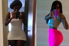 Για να αποκτήσει καμπύλες έκανε ενέσεις με... σογιέλαιο