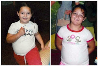 12χρονη έκανε επέμβαση στομάχου για να αδυνατίσει! - Φωτογραφία 1
