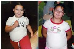 12χρονη έκανε επέμβαση στομάχου για να αδυνατίσει!