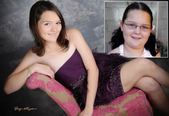 12χρονη έκανε επέμβαση στομάχου για να αδυνατίσει! - Φωτογραφία 3