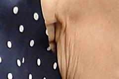 «Ζάρωσε» το δέρμα πασίγνωστης ηθοποιού