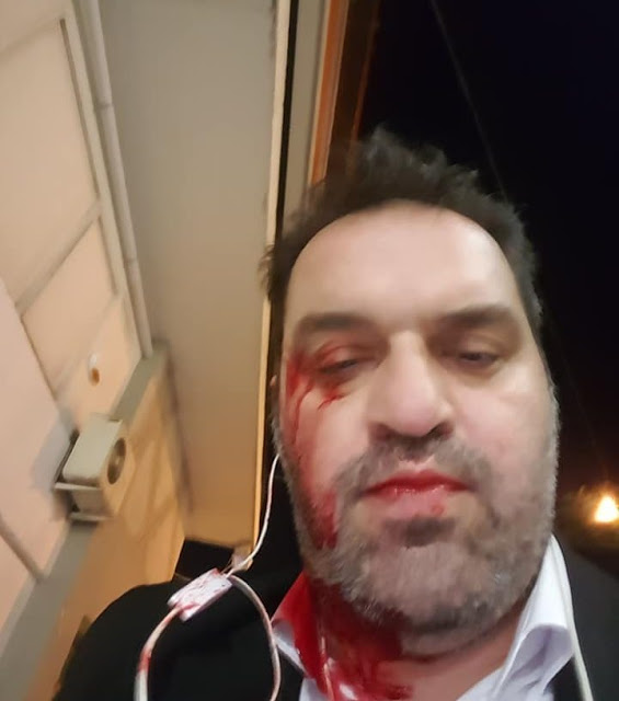 Επίθεση σε γνωστό δικηγόρο με χτυπήματα στο κεφάλι - Φωτογραφία 1
