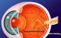 Αιτίες απώλειας όρασης και τρόποι αντιμετώπισης. Παγκόσμια Ημέρα Όρασης (κατά της τύφλωσης) - Φωτογραφία 3