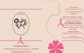 Εκδήλωση για τον καρκίνο του μαστού που διοργανώνουν οι «Ιωνίδες» - Φωτογραφία 2