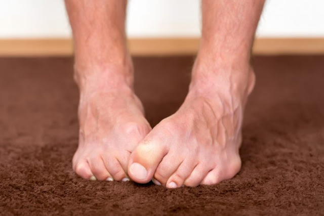 Τι μπορεί να αποκαλύψει το χρώμα των νυχιών στα πόδια μας για την υγεία μας; - Φωτογραφία 1