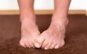 Τι μπορεί να αποκαλύψει το χρώμα των νυχιών στα πόδια μας για την υγεία μας; - Φωτογραφία 1