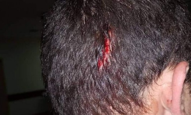 Εικόνες-σοκ: Τα τραύματα των αστυνομικών από την επίθεση των Ρομά στου Ρέντη - Φωτογραφία 1
