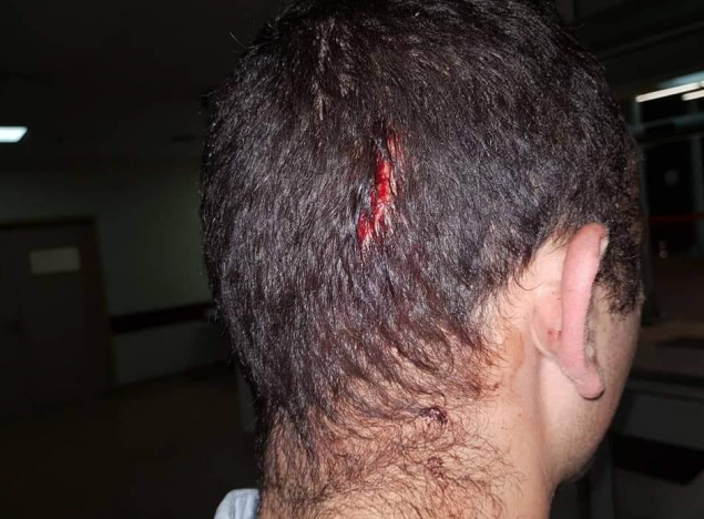 Εικόνες-σοκ: Τα τραύματα των αστυνομικών από την επίθεση των Ρομά στου Ρέντη - Φωτογραφία 4