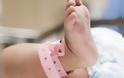 Γαλλία: Σε 18 ανέρχονται τα παιδιά που γεννήθηκαν χωρίς χέρια! Έρευνα διεξάγεται από τη δημόσια υπηρεσία Υγείας