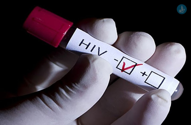 Αύξηση κρουσμάτων του ιού HIV παρατηρείται στις ηλικίες 50 – 64 ετών - Φωτογραφία 1