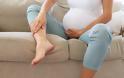 Εγκυμοσύνη: Πότε είναι απαραίτητος ο έλεγχος των φλεβών; - Φωτογραφία 1