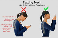 «Text neck»: Τι είναι και με ποια συμπτώματα εκδηλώνεται; Πώς θα το αντιμετωπίσετε; - Φωτογραφία 2