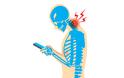 «Text neck»: Τι είναι και με ποια συμπτώματα εκδηλώνεται; Πώς θα το αντιμετωπίσετε;
