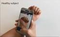 «Έξυπνο» app επιτρέπει τη διάγνωση-εξπρές της αναιμίας από φωτογραφίες των νυχιών - Φωτογραφία 2