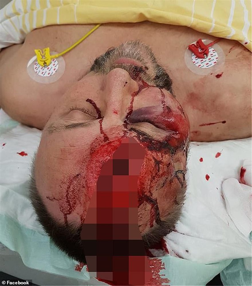 Γερμανία: Σοβαρά τραυματισμένος ο ακροδεξιός βουλευτής Φρανκ Μάγκνιτς - Φωτογραφία 2