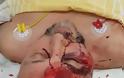 Γερμανία: Σοβαρά τραυματισμένος ο ακροδεξιός βουλευτής Φρανκ Μάγκνιτς - Φωτογραφία 2