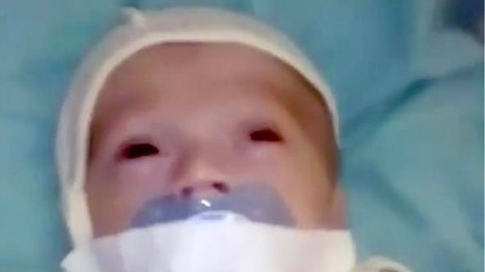 Κόλλησαν με μονωτική ταινία την πιπίλα στο στόμα μωρού σε νοσοκομείο - Φωτογραφία 1