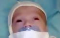 Κόλλησαν με μονωτική ταινία την πιπίλα στο στόμα μωρού σε νοσοκομείο