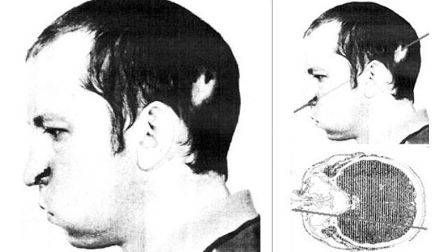Ο άνθρωπος που έβαλε το κεφάλι του σε επιταχυντή σωματιδίων - Φωτογραφία 1