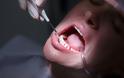 Ποιο σημάδι στα δόντια μπορεί να είναι ένδειξη για διαβήτη τύπου 2;
