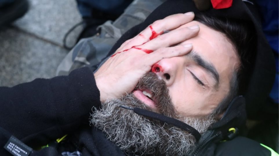 Ηγετική μορφή των Κίτρινων Γιλέκων τραυματίστηκε σοβαρά στο μάτι κατά τη χθεσινή διαδήλωση - Φωτογραφία 1