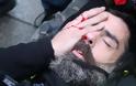 Ηγετική μορφή των Κίτρινων Γιλέκων τραυματίστηκε σοβαρά στο μάτι κατά τη χθεσινή διαδήλωση