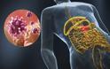 Νοροϊός: Τι πρέπει να γνωρίζουμε για τον ιό που προκαλεί γαστρεντερίτιδα