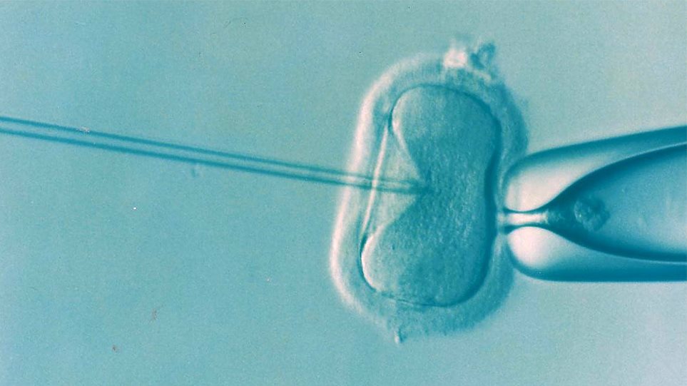 Εξωσωματική γονιμοποίηση: Ελαφρώς αυξημένος ο κίνδυνος επιπλοκών στην κύηση - Φωτογραφία 1