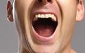 Καρκίνος του στόματος: Ανησυχία προκαλεί στους επιστήμονες η αύξηση των κρουσμάτων - Φωτογραφία 1