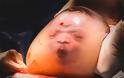 Φωτογραφίες-σοκ: Μωρό γεννήθηκε μέσα στον αμνιακό σάκο - Φωτογραφία 5